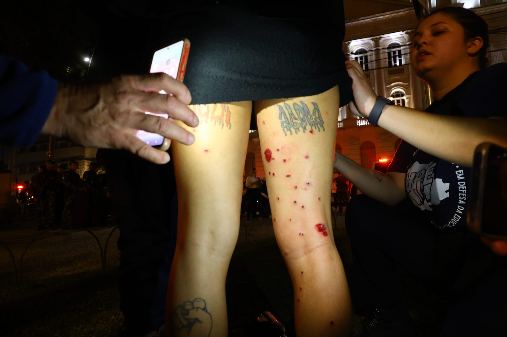 Estudante foi atingida na perna por balas de borracha / Foto: Tami Taketani/Plural