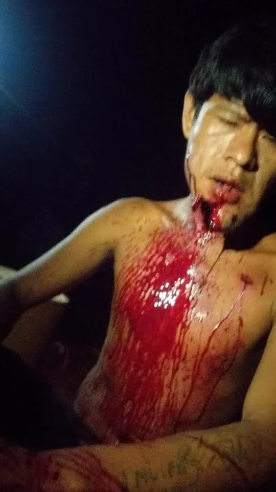 Elízio Galeno foi atingido no rosto em um crime que ainda não foi solucionado. Foto: Comunidade avá-guarani.