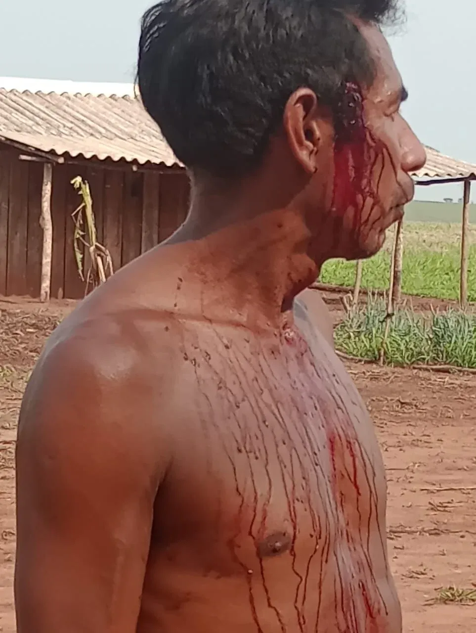 O Cacique Bernardo foi um dos feridos durantes os diversos ataques contra sua aldeia, a retomada Yvyju Avary. Foto: Comunidade avá-guarani.