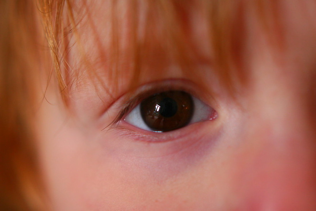 Começo de ano letivo é hora de ver se os olhos estão bem