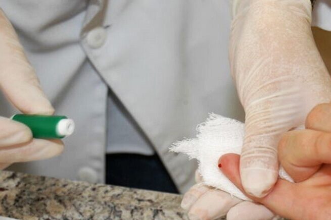 Curitiba passa por um surto de hepatite A; saiba como se prevenir