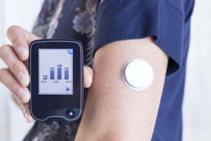 Governo Federal abre consulta pública para incorporar sensor de monitoramento de glicose no SUS