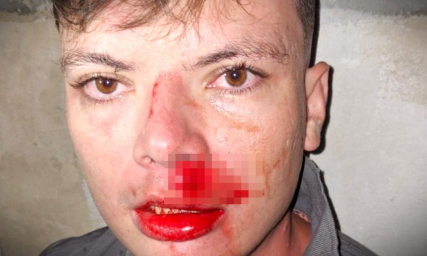 Assessor de deputado petista é agredido a chutes em Guarapuava
