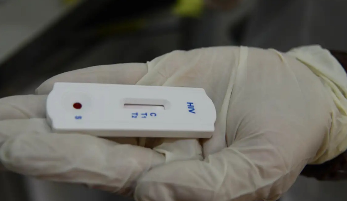 Trump corta financiamento e programa que atende pacientes com HIV é prejudicado em Curitiba